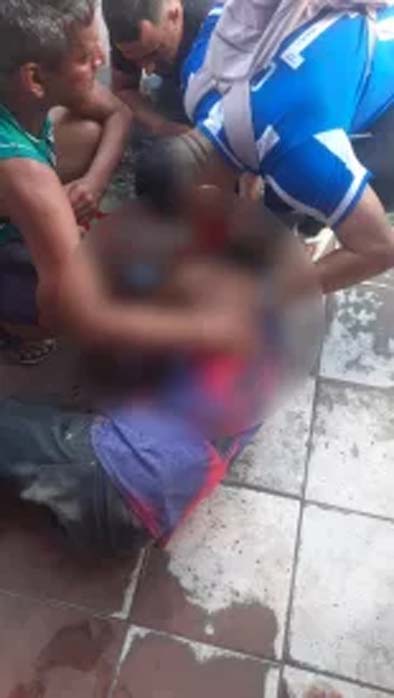 Homem fica ferido após ser atingido com tiro na cabeça