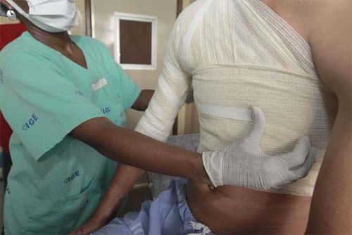 Homem é vítima de roubo violento e sofre queimaduras após encontro por aplicativo