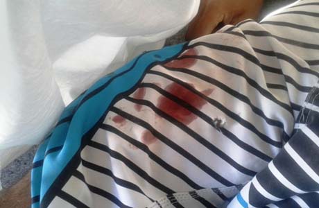 Homem é morto a tiros durante assalto a van de passageiros na AL 220