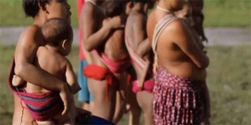 Malária e desnutrição persistem na Terra Yanomami sob governo Lula