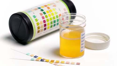 Por que infecção urinária afeta 50% das mulheres e é tratada de forma pouco eficaz