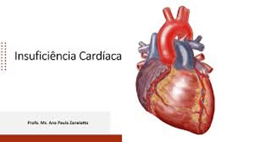 Insuficiência cardíaca: o que é, sintomas, riscos e prevenção