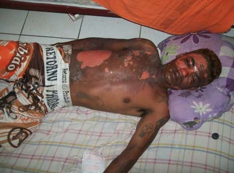 Preso é queimado vivo na delegacia de Delmiro Gouveia