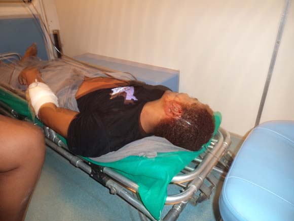 Mais violencia em União - agricultor é baleado no Bairro Sagrada Familia na noite deste sabado