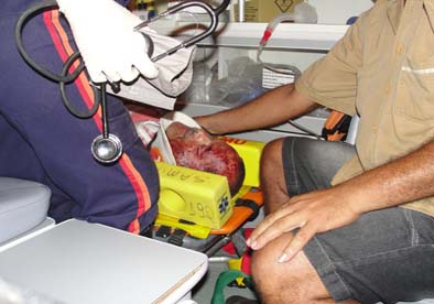 Sargento Jedison de União dos Palmares não resistiu a cirurgia e faleceu em Arapiraca