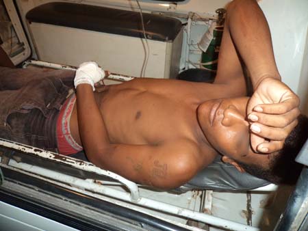 Menor sofre atentado à bala no centro de União dos Palmares