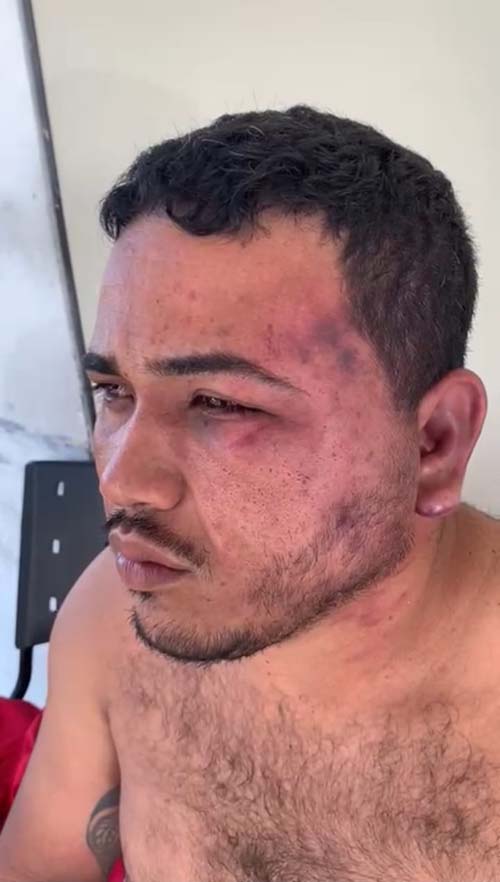 Advogado é impedido de atuar e denuncia militares por crime de tortura em Arapiraca