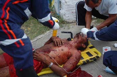 Homem é esfaqueado no Francês e seu estado de saúde é grave