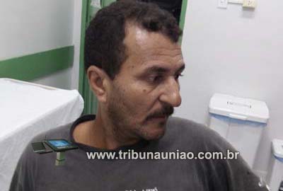 Bandidos atiram em portador de necessidades especiais na periferia de União