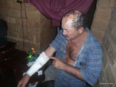 Idoso é espancado e assaltado dentro da própria casa em Santana do Ipanema