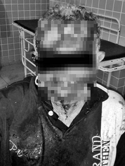 Homem é agredido a golpes de faca pelo sobrinho que queria tomar suas terras