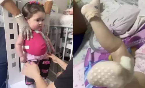 Menina de 2 anos que recebeu remédio mais caro do mundo mexe as pernas pela 1ª vez