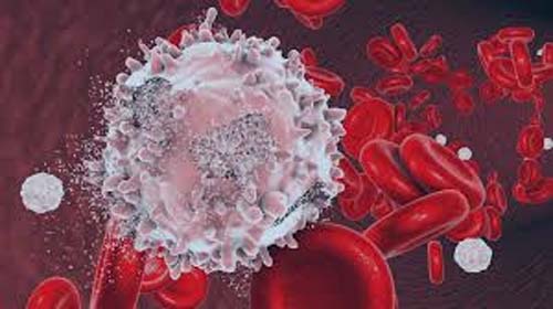 Leucemia mieloide: o que é, sintomas e tratamento