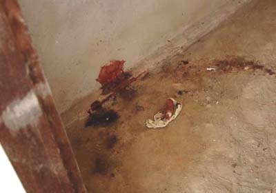 Mulher é estuprada e espancada na orla lagunar de Marechal