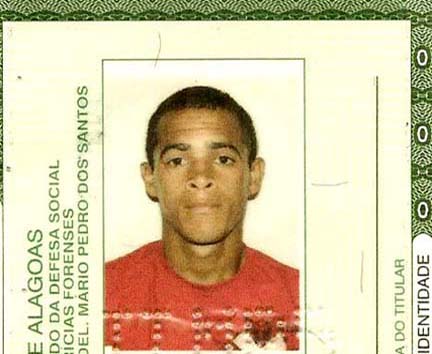 Morre no HGE garçom que levou tiro na cabeça em União dos Palmares