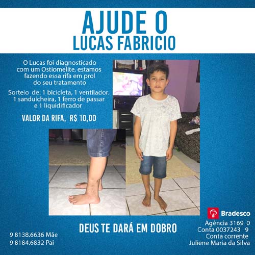 Em Arapiraca, amigos realizam bingo para custear tratamento de criança com doença óssea