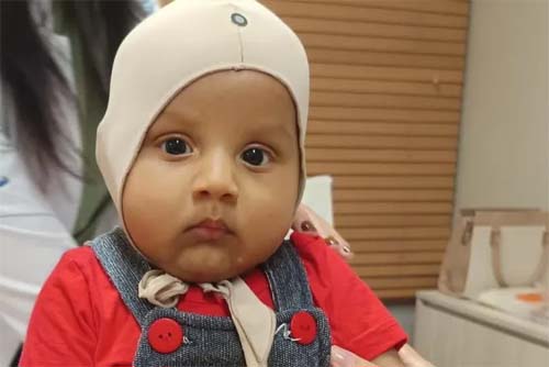 Pais de bebê com assimetria craniana iniciam campanha para tratamento urgente