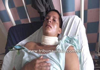 Cortador de cana é agredido com golpe de facão no pescoço na periferia de União