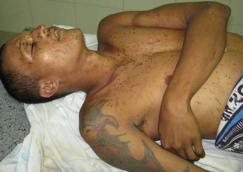 Suposto usuário de drogas é executado a tiros no Centro de São Miguel dos Campos