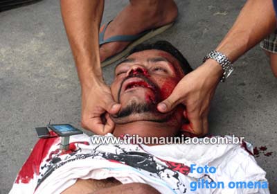 Menor atropela com motocicleta auxiliar de serviços gerais em União