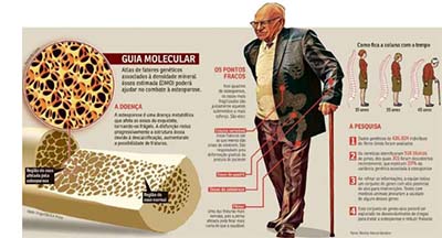 Atlas da osteoporose mostra fatores genéticos ligados à doença
