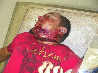 Homem morre e garupa fica gravemente ferida durante acidente de moto em Água Branca