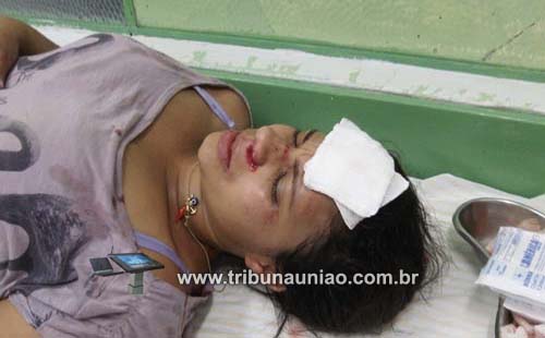 Tampa traseira de caçamba se solta a atinge rosto de agricultora em União