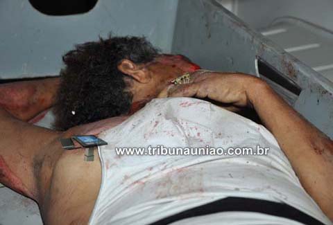 Mulher que provavelmente residia em União morre atropelada na BR-104 em Murici