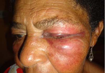 Policial civil ataca com soco no olho idosa de 63 anos 