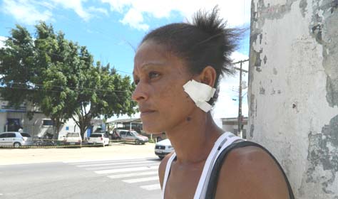 Após briga marido corta orelha da mulher com o uso de um facão