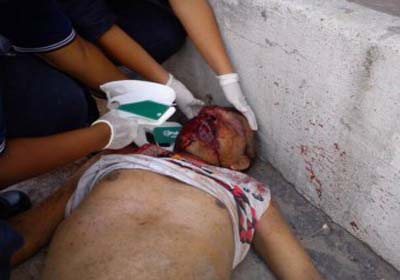 Masturbador é apedrejado por população revoltada