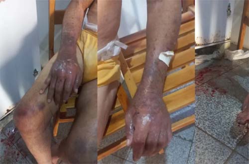 Filha é detida por maus-tratos e negligência a idoso em Belo Monte