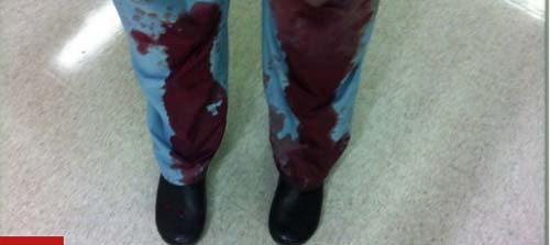 Por que médicos americanos estão postando fotos cobertos de sangue