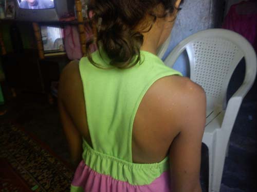 Menina de oito anos é espancada e estuprada em Mata Grande