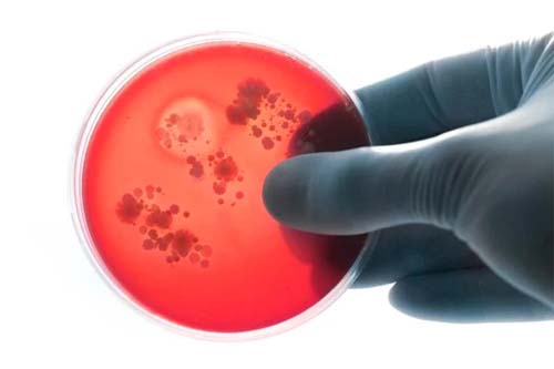 Dia mundial da meningite: aprenda a reconhecer 10 sintomas da doença