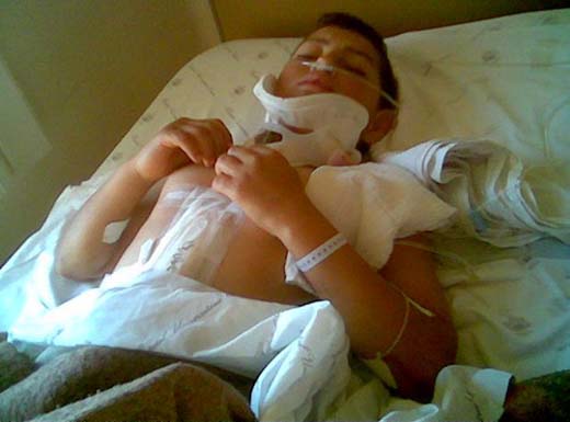 Garoto de 12 é atingido por bala perdida em Feira Grande