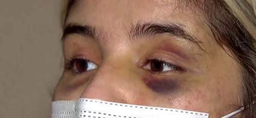 A cada minuto, oito mulheres foram agredidas fisicamente no Brasil durante a pandemia