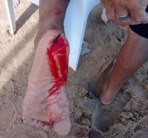 Banhistas são atacados por piranhas em 'prainha' de Pão de Açúcar; saiba mais