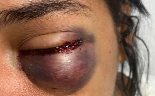 Homem de 32 anos é preso em flagrante por agredir mulher em motel no Trapiche da Barra