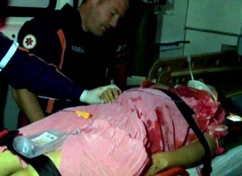 Mulher é baleada na cabeça durante suposta tentativa de assalto