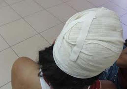 Mulher leva facada na cabeça e prefere não falar nome do acusado 