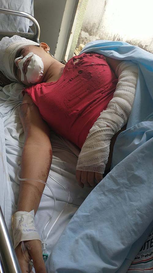 Mulher pula de van em movimento para fugir de estupro em Campo Alegre