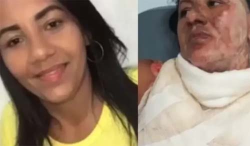 Filha incendeia casa da mãe após morte causada por queimaduras provocadas pelo companheiro