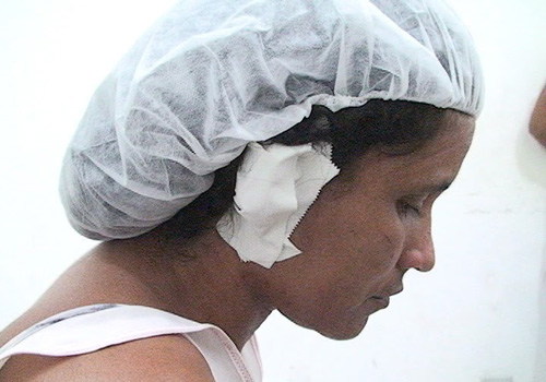 Após discussão, homem arranca parte da orelha da esposa com mordida 