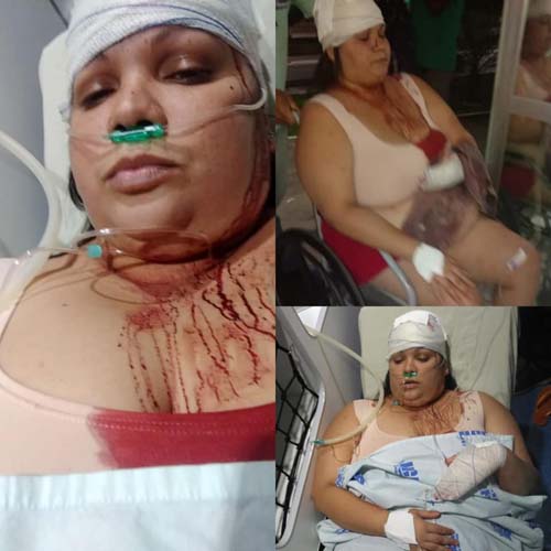 Homem tenta matar esposa a golpes de cacete em São José da Laje