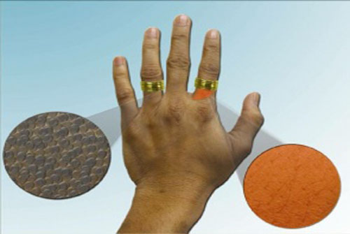 Uso de nanotecnologia prevê o fim de comprimidos e agulhas