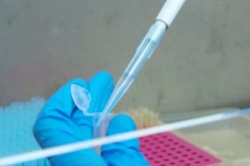 Estudo com nitazoxanida tem resultado positivo para tratar covid