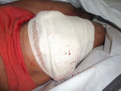 Homem é baleado, foge do assassino, mas morre no hospital em Delmiro Gouveia