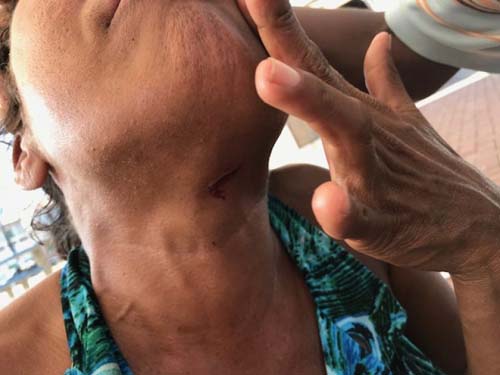 Moradora de rua grávida é agredida após homem não aceitar fim de relacionamento em Penedo