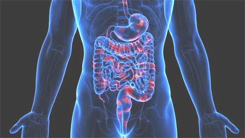 O que é obstrução intestinal, condição que levou Bolsonaro à cirurgia